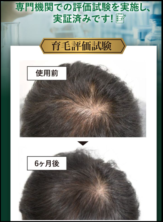 モアグロースアップの育毛評価試験の結果画像